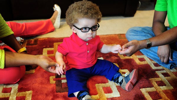 Noah Miller is 10 months old and has albinism, a genetic condition that causes little or no pigmentation in his skin, hair and eyes. (Reporter photos/Jon Goering)